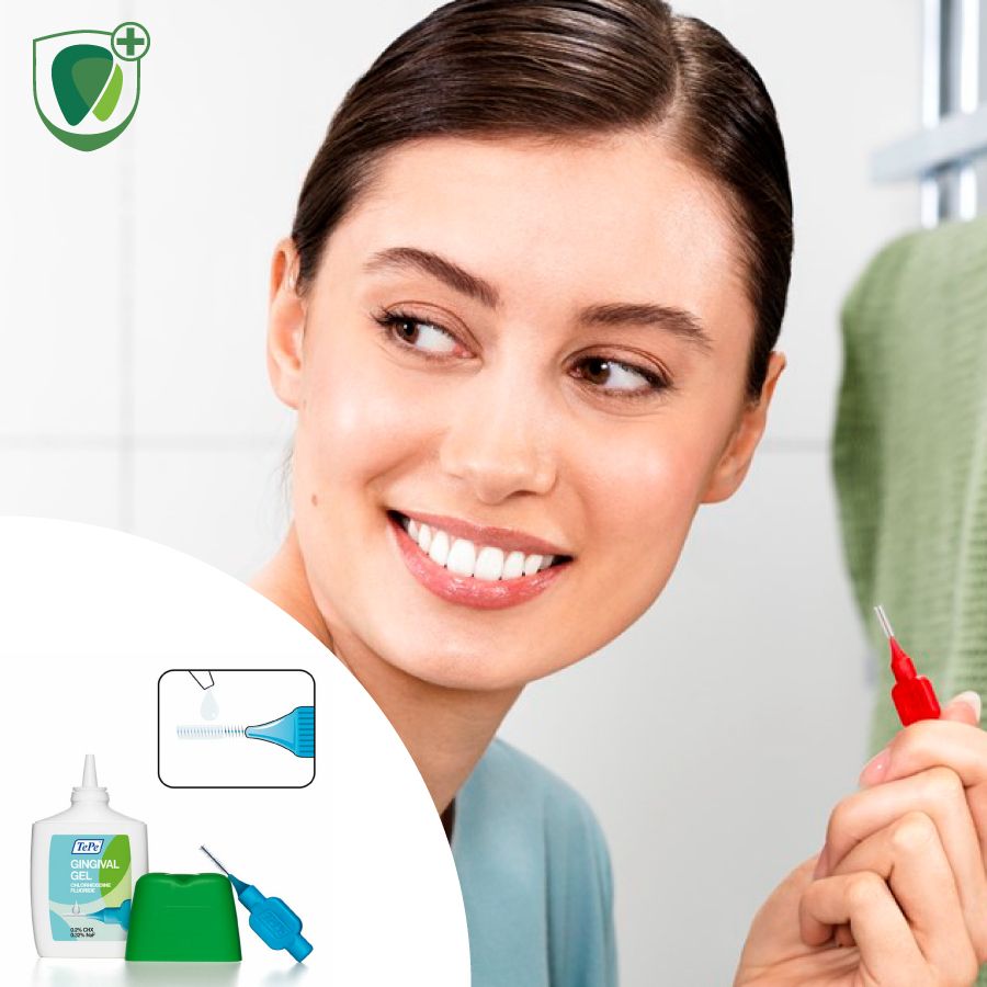 Gel Fluor và Chlorhexidine ngăn ngừa viêm nướu Tepe Gingival