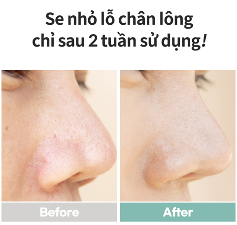  Kem Dưỡng Phục Hồi Hỗ Trợ Cân Bằng Dầu Thu Nhỏ Lỗ Chân Lông - Pore Tightening Cream 50ml 