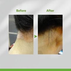 Nước dưỡng ẩm dành cho da đầu AROMASE Glycyrrhetinic Acid Skincare Tonic 80ml