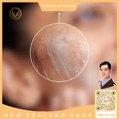 Lotion rửa mặt và tẩy trang 2 in 1 DermEden Complete Cleanser 2in1 Milk Lotion 150ml