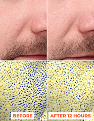 Bộ đôi lột da sinh học nâng cao Pre-Peel và Peel DermEden Advanced Peel 2x30ml