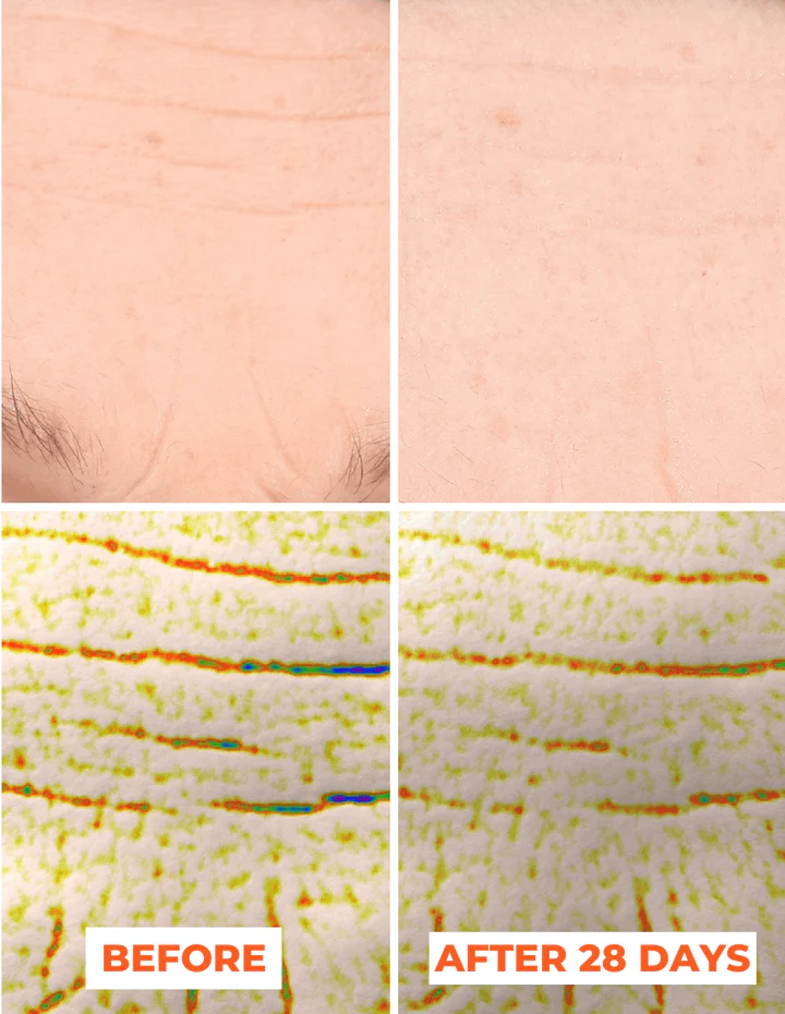 Bộ đôi lột da sinh học nâng cao Pre-Peel và Peel DermEden Advanced Peel 2x30ml