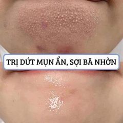 [Thanh Lý 09/2024 ] Kem Dưỡng Obagi Retinol 0.5% Ngăn Ngừa Lão Hoá Da 28g Retinol 0.5 Cream