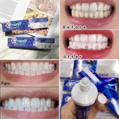Kem Đánh Răng Trắng Răng Hiệu Quả CREST 3D White Advanced Triple Whitening & Ultra Vivid Mint 135G 147G 153G