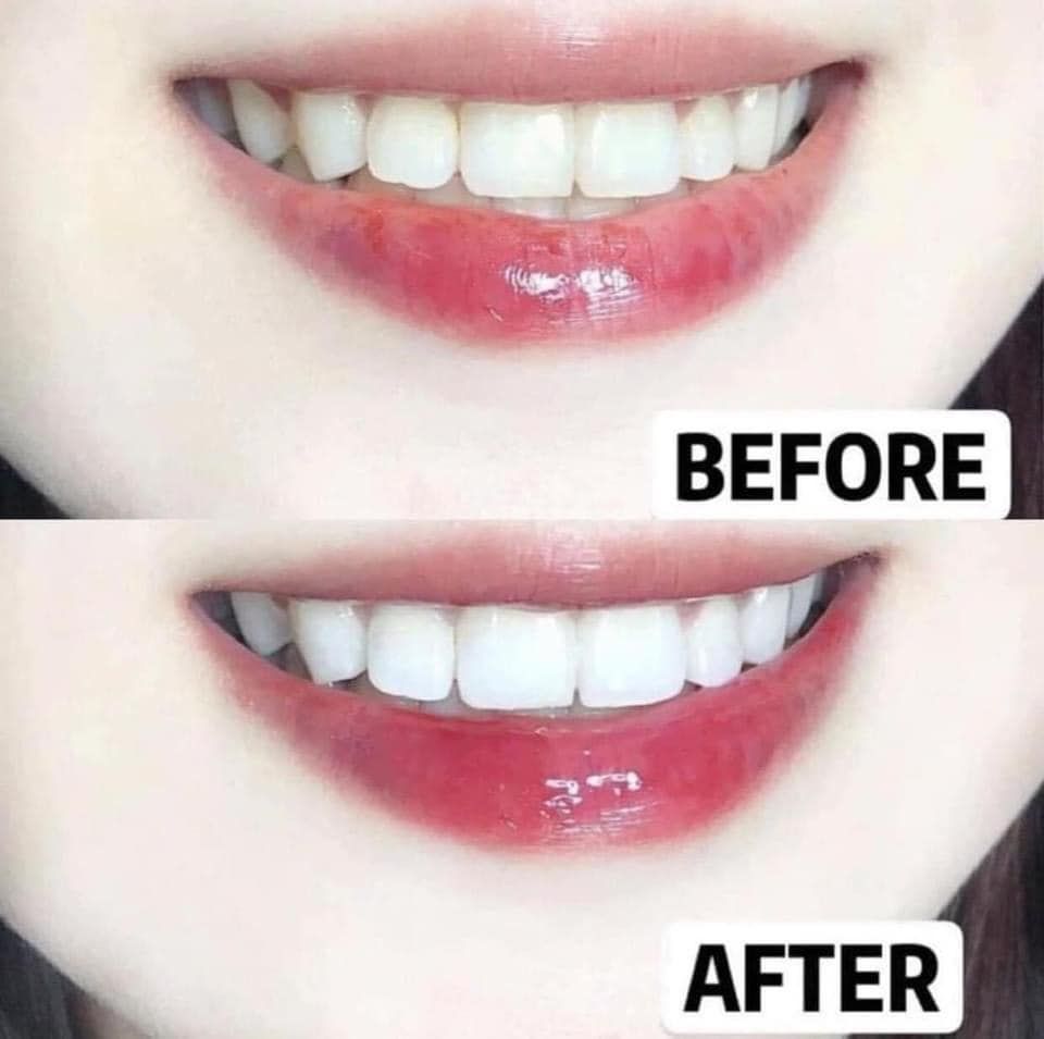Kem Đánh Răng Làm Trắng Răng Eucryl Toothpaste 62g - Bột Trắng Răng Eucryl