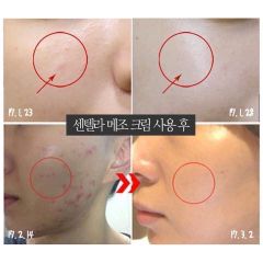Kem Trị Mụn Phục Hồi Da Medi-Peel Centella Mezzo Cream 30ml