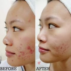 Kem Trị Mụn Phục Hồi Da Medi-Peel Centella Mezzo Cream 30ml