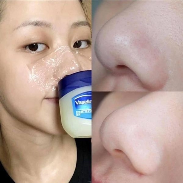 Sáp Dưỡng Ẩm Vaseline Pure Petroleum Jelly Original #368g #49g