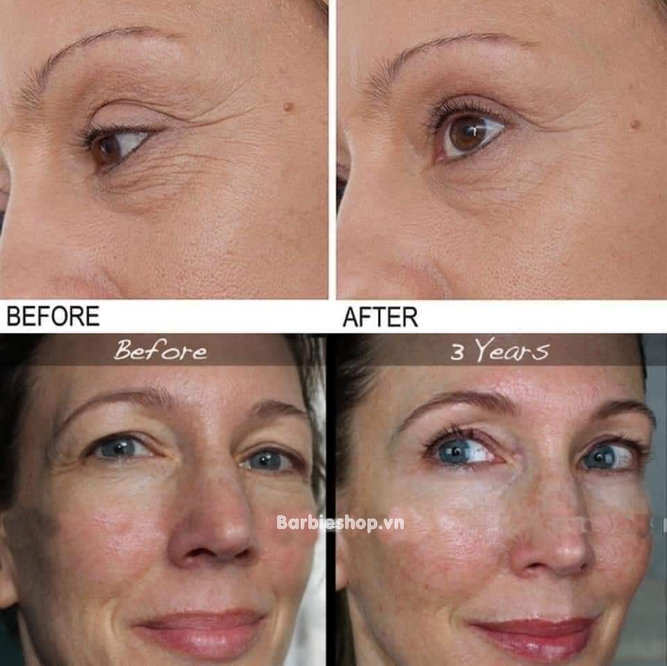 Tinh Chất Chống Lão Hóa The Ordinary Retinol 0.5% In Squalane  30ml