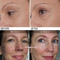 Tinh Chất Chống Lão Hóa The Ordinary Retinol 0.5% In Squalane  30ml