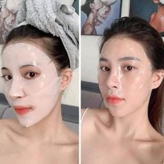 Mặt Nạ Cao Cấp Derm All Matrix Facial Dermal-Care Mask - Miếng Lẻ