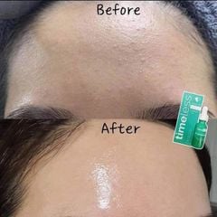 Serum Timeless Vitamin B5 Làm Dịu & Phục Hồi Da 30ml