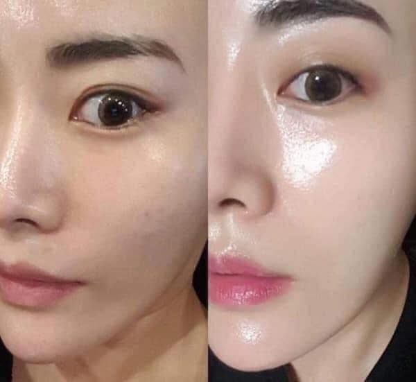 Kem Dưỡng Medi Peel Bor Tox Peptide Cream 50g - Serum 30ml