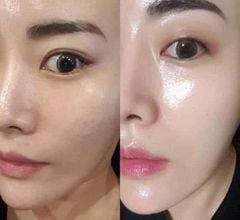 Kem Dưỡng Medi Peel Bor Tox Peptide Cream 50g - Serum 30ml