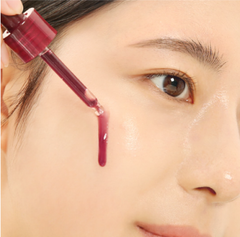 Tinh chất tẩy da chết hóa học So'Natural Red Peel Tingle / red peel white Serum 11ml - 35ml