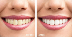 Kem Đánh Răng Trắng Răng Hiệu Quả CREST 3D White Advanced Triple Whitening & Ultra Vivid Mint 135G 147G 153G