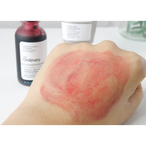 Serum Tẩy Da Chết The Ordinary AHA 30% BHA 2% Peeling Solution 30ml