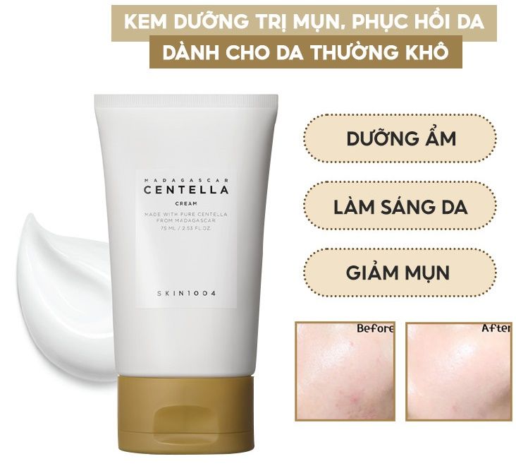 Kem Dưỡng Da Chiết Xuất Rau Má Skin1004 Centella Asiatica Cream + Madagascar Soothing Cream + Hyalu-Cica Moisture Cream 75ml