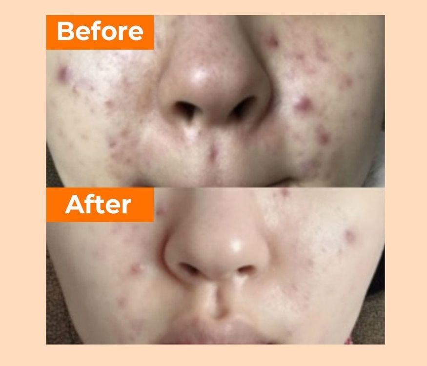 Serum Numbuzin 5+ Vitamin Concentrated Serum 30ml
