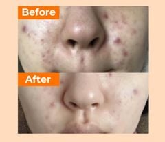 Serum Numbuzin 5+ Vitamin Concentrated Serum 30ml