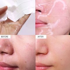 Mặt Nạ Thạch Celderma Ninetalks Hydrogel Mask - Hồng