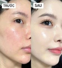 Kem Nền Estee Lauder Double Wear Stay in Place SPF10