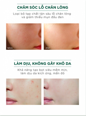 Sữa Rửa Mặt Ngăn Ngừa Mụn Giảm Thâm Caryophy Portulaca Cleansing Foam 150ml