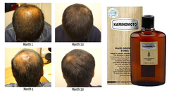 Dưỡng Mọc Tóc Kaminomoto 150ml Nhật