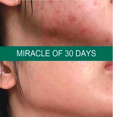 Nước Hoa Hồng Some By Mi AHA-BHA-PHA 30 Days Miracle Toner 150ML