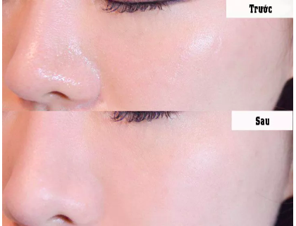 Phấn Phủ Nén Catrice All Matt Plus Shine Control Powder