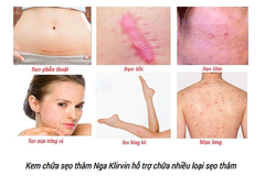 Kem Làm Mờ Sẹo KJINPBNH 25g