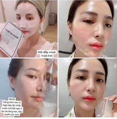Mặt Nạ Cao Cấp Derm All Matrix Facial Dermal-Care Mask - Miếng Lẻ