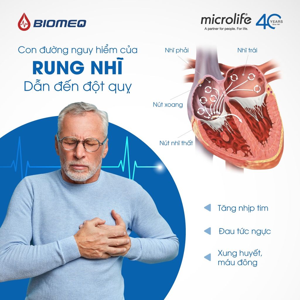 Máy Đo Huyết Áp Điện Tử Bắp Tay Microlffe A5 (BP 3GC-5F) - Công Nghệ AFIB Cảnh Báo Rung Nhĩ, Phòng Đột Quỵ