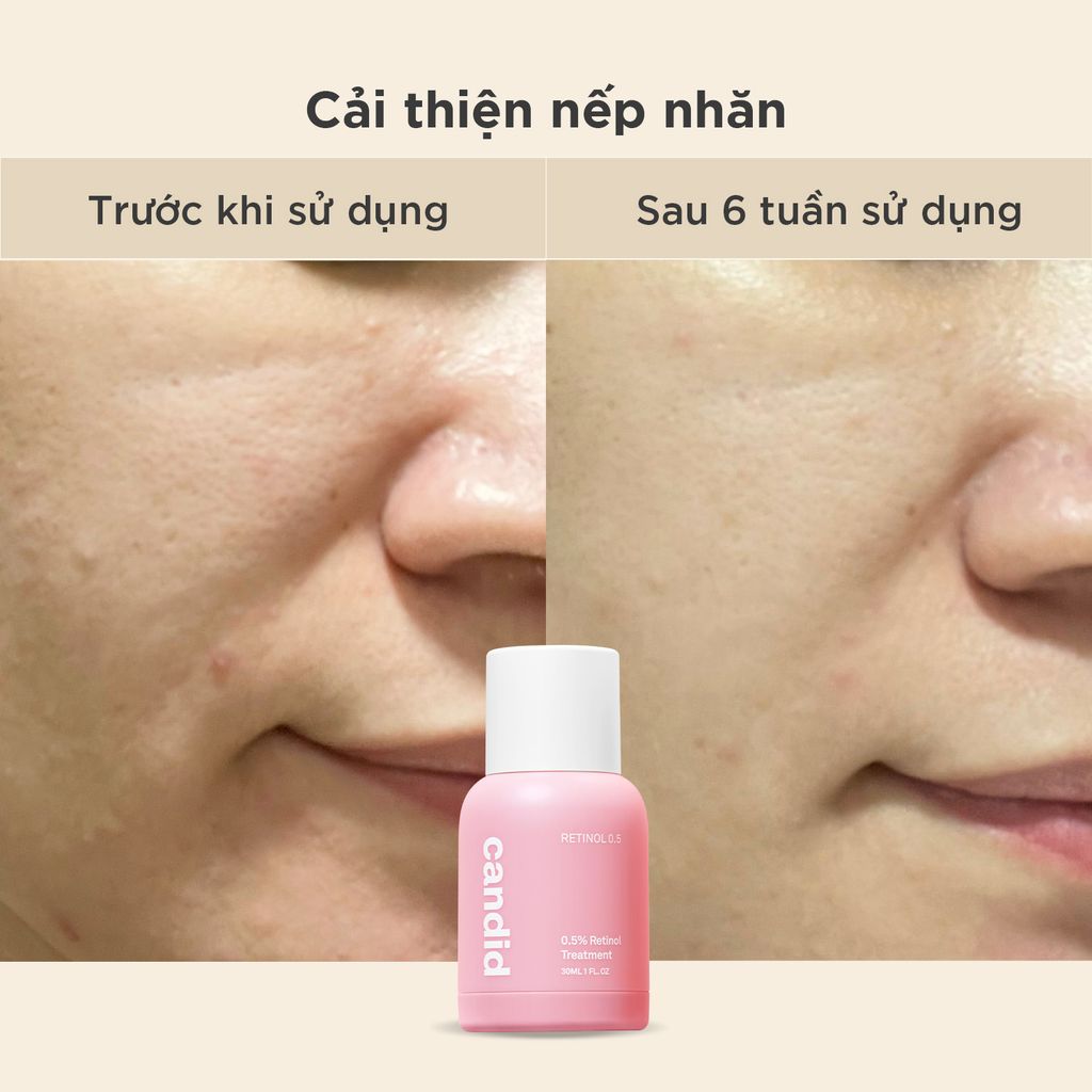 Tinh chất Retinol 1.0