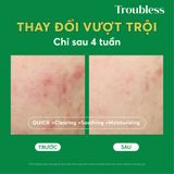  Toner pad bông tẩy trang Troubless hỗ trợ tẩy tế bào chết, làm sạch sâu, giảm mụn, làm sáng da (60 miếng) 