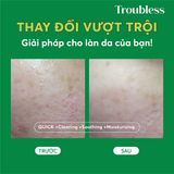  Sữa rửa mặt tạo bọt Troubless dịu nhẹ hỗ trợ kiểm soát nhờn mụn, làm sạch sâu 120ml 