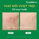  Nước cân bằng Troubless làm dịu da tẩy tế bào chết, sáng da, giảm mụn 200m 