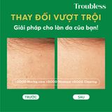  Gel rửa mặt tạo bọt Troubless dịu nhẹ hỗ trợ kiểm soát nhờn mụn, làm sạch sâu 120ml 