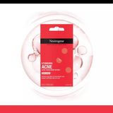 Miếng Dán Mụn Neutrogena Stubborn – Siêu Mỏng, Hút Mụn Hiệu Quả
