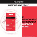 Miếng Dán Mụn Neutrogena Stubborn – Siêu Mỏng, Hút Mụn Hiệu Quả