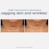 Kem dưỡng da chống lão hóa da vùng cổ và ngực NEOSTRATA Skin Active Triple Firming Mỹ