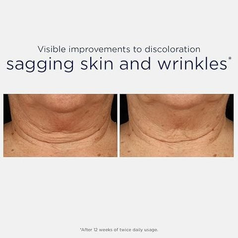 Kem dưỡng da chống lão hóa da vùng cổ và ngực NEOSTRATA Skin Active Triple Firming Mỹ