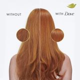 Dầu gội phục hồi tóc hư tổn chuyên sâu Dove Shampoo Intensive Repair 532 mL [Mỹ]