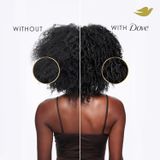 Giải Cứu Tóc Xoăn Khô Xơ Với Dove Amino Curl – Dưỡng Sâu, Giữ Nếp Lâu