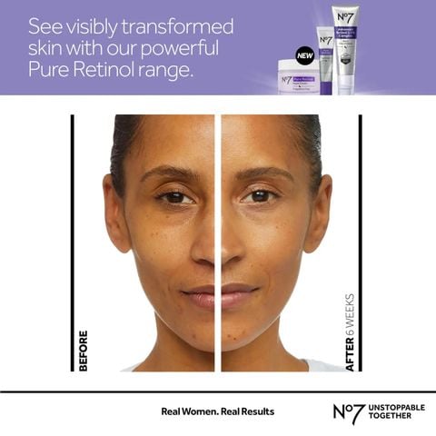 No7 - Kem tái da mặt và cổ - Pure Retinol Night Cream