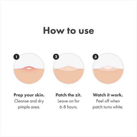 Miếng Dán Mụn Hero Mighty Patch – Mega Pack Hydrocolloid, Hút Sạch Mụn Trong 6 Giờ