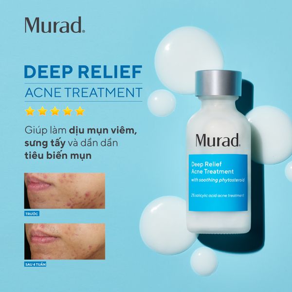 Đặc trị giảm mụn chuyên sâu Deep Relief Acne Treatment 30ml – Murad Việt Nam