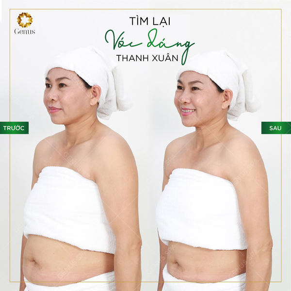  Giảm béo Chuyên sâu 
