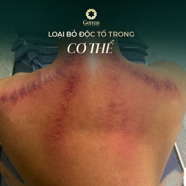  Massage Body Cơ bản 