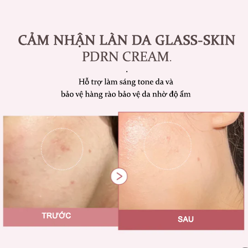  [ĐẶT TRƯỚC - 20/7 TRẢ HÀNG]  PDRN Pink Hyaluronic Moisturizing Cream 50ml 